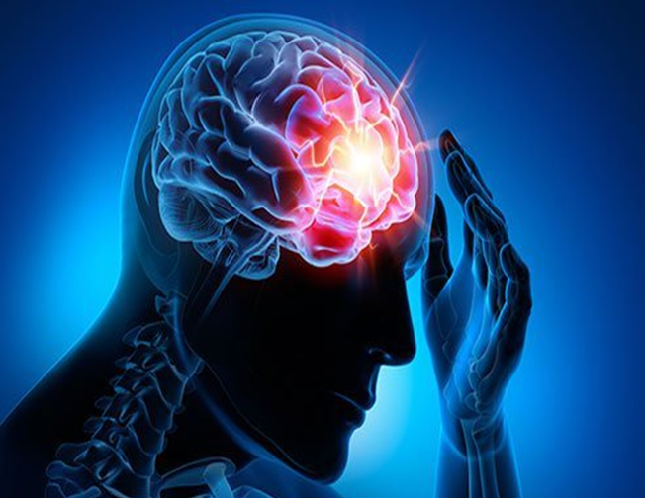 NAD + Infusion by IV Hydration4U